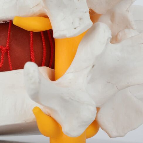 Axis Scientific Human Lumbar Herniating Disc Demonstration Anatomy Model | for Teaching and Learning, Human anatomy system miniature, scientific anatomy model in Kuwait