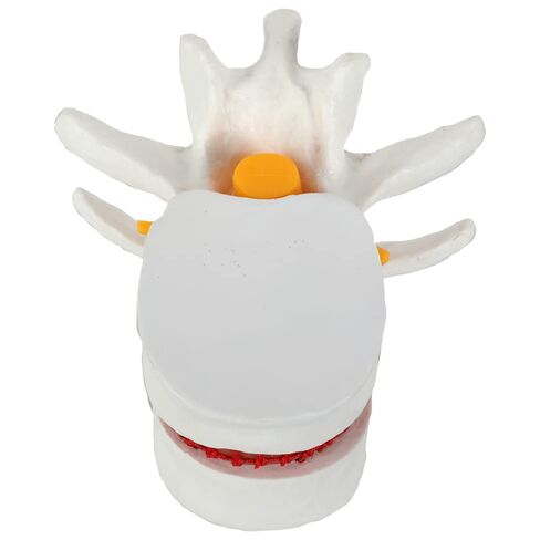 Axis Scientific Human Lumbar Herniating Disc Demonstration Anatomy Model | for Teaching and Learning, Human anatomy system miniature, scientific anatomy model in Kuwait