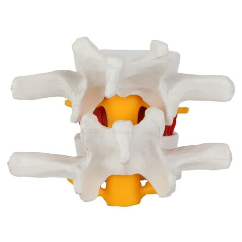 Axis Scientific Human Lumbar Herniating Disc Demonstration Anatomy Model | for Teaching and Learning, Human anatomy system miniature, scientific anatomy model in Kuwait