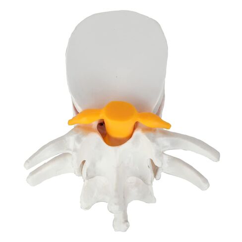 Axis Scientific Human Lumbar Herniating Disc Demonstration Anatomy Model | for Teaching and Learning, Human anatomy system miniature, scientific anatomy model in Kuwait