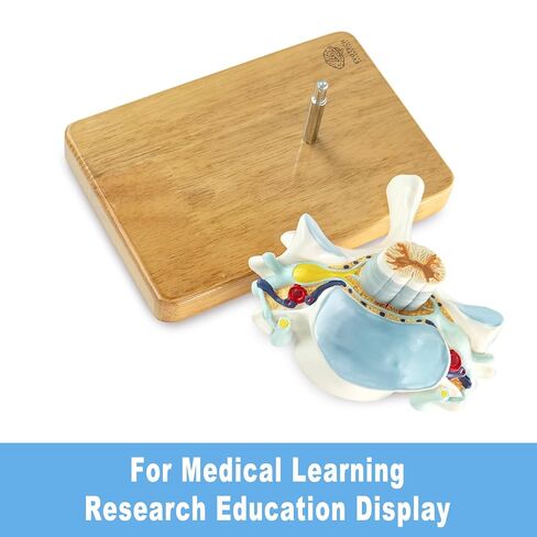 EVOTECH SCIENTIFIC Enlarged Human Cervical Vertebra Model with Spinal Cord - 2× Cervical Spine Model on Base with Manual – Anatomy Teaching Tool for Medical Students PT Chiropractors in Kuwait