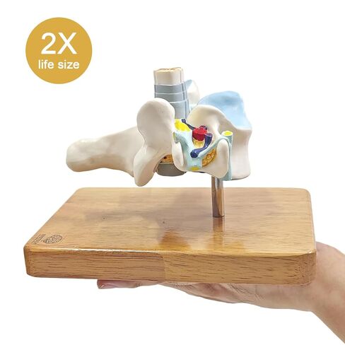 EVOTECH SCIENTIFIC Enlarged Human Cervical Vertebra Model with Spinal Cord - 2× Cervical Spine Model on Base with Manual – Anatomy Teaching Tool for Medical Students PT Chiropractors in Kuwait