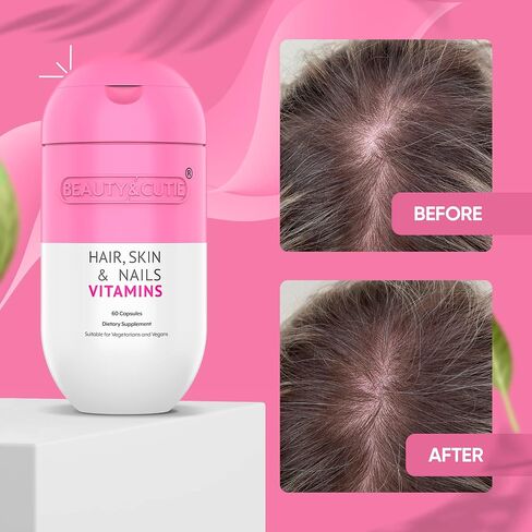 BEAUTY AND CUTIE Hair Skin and Nails Vitamins – Hair Nails and Skin Vitamins for Women – Vitamin Supplements with Hyaluronic Acid, Biotin for Hair Growth – Non-GMO and Gluten-Free- 60 Count in Saudi Arabia
