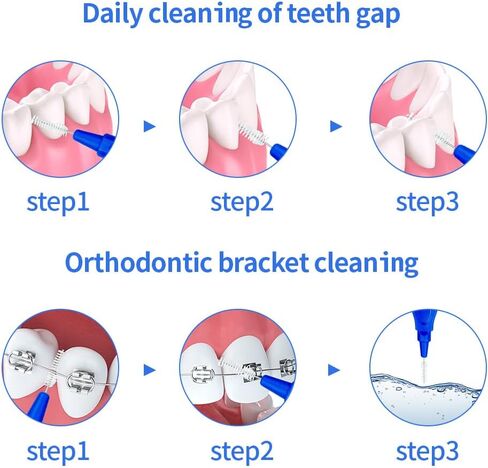 20pcs Interdental Brushes, Short Handle I-Shaped Soft Bristled Dental Picks, Reusable Floss Pick Orthodontic Teeth Clean Between Teeth Mini Oral Care Tool (Blue（1.0-1.2mm）) in Kuwait
