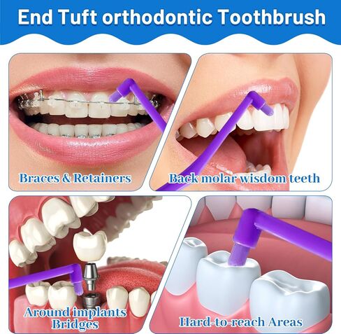 6 Pack Angled End-Tuft Toothbrushes with Covers for Orthodontic Wisdom Teeth Care, Small Head Single Tuft Dental Brush for Plaque Removal, Braces, Interdental Cleaning, Soft Bristles for Oral Care in Kuwait