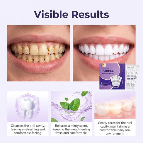 Purple Mouthwash Whitening Sachets 20 Pack – Color Correcting Formula, Alcohol & Peroxide Free, Fresh Mint, Travel Portable Oral Care (1 Boxes) in Kuwait