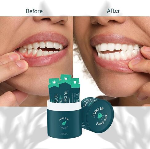 Primal Life Organics - زيت سحب أبيض حقيقي، غسول فم لتبييض الأسنان بالزيوت العطرية، جوز الهند، شجرة الشاي، فيتامينات أساسية، خالي من المواد الكيميائية، خالي من الفلورايد، 14 كيسًا (نعناع طازج، 0.33 أونصة) in Kuwait