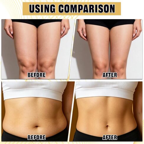 20 PCS Instant Thigh Lifts, Waterproof Thigh Lift Tape for Loose Skin, Transparent Anti-Friction Instant Lift Tape for Women Arm, Legs, Tummy & Back in Kuwait