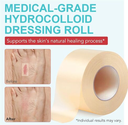 Hydrocolloid Roll for Wound Care, Extra Large Hydrocolloid Patch Bandages with Self-Adhesive, Hydrocolloid Tape, Ultra Absorbent, Flexible & Waterproof DIY Size & Shape(2in*11.8ft) in Saudi Arabia