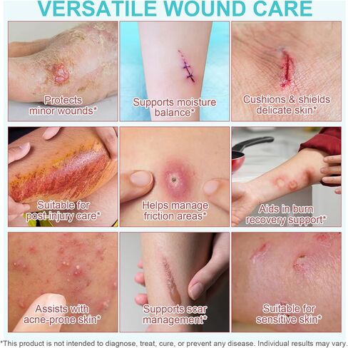 Hydrocolloid Roll for Wound Care, Extra Large Hydrocolloid Patch Bandages with Self-Adhesive, Hydrocolloid Tape, Ultra Absorbent, Flexible & Waterproof DIY Size & Shape(2in*11.8ft) in Saudi Arabia