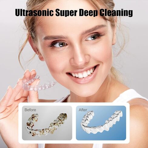 Ultrasonic Retainer Cleaner Machine 45kHz Dental Retainer Cleaner with 3 Modes and Digital Timer Mouth Guard for Retainer Clean, Denture Clean,Braces, Aligner, Jewelry 200ML in Kuwait