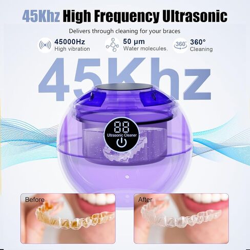 Ultrasonic Retainer Cleaner Machine 45kHz Dental Retainer Cleaner with 3 Modes and Digital Timer Mouth Guard for Retainer Clean, Denture Clean,Braces, Aligner, Jewelry 200ML in Kuwait