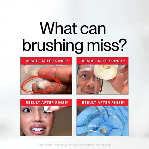 Stain Mouthwash - Gunk Removing Oral Rinse for Build-Up Control & Fresh Breath, Gentle Teeth Care. 1pcs in Kuwait