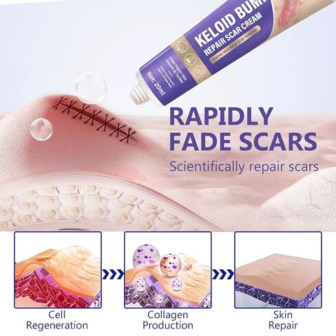 Keloid Bump Removal, Silicone Gel Hydrating Cream for Skin Bumps and Marks | Scar gel-cream intensely hydrates, softens uneven skin texture, for Face & Body in Kuwait