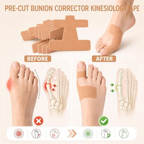 40 Pcs Pre-Cut Bunion Corrector Kinesiology Tape, Elastic Waterproof Bunion Tape for Bunion Pain Relief, Latex-Free Toe Support Strips, Self-Adhesive Hallux Valgus Corrector for All People in Kuwait