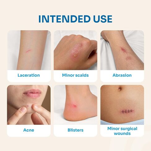 ضمادات الجروح الغروانية المائية كونكوت 2 × 2 بوصة رفيعة للغاية مقاومة للماء غرواني مائي 10 عبوات in Kuwait