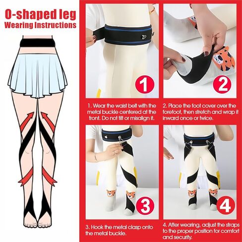O/X Type Leg Correction Belt for Childs - Leg Posture Corrector Band, Pediatric Orthopedic Straightening Bandage in Saudi Arabia