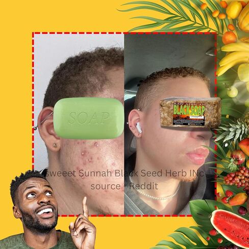 Premium African Black Soap - Pure 1 pound Bulk. Raw Organic Soap for Acne, Dry Skin, Rashes, Burns, Scar Removal, Face & Body Wash, From Ghana West Africa - Authentic African Moisturizer in Saudi Arabia