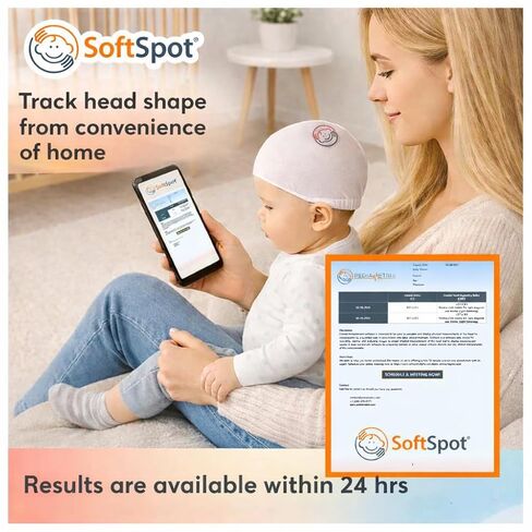 SoftSpot Baby Head Shape Measurement Kit – Measure at Home, iOS & Android in Kuwait