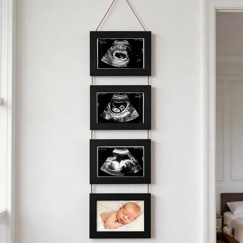 4-in-1 Ultrasound Picture Frames, Baby's First Sonogram Photo Album, Black | Pregnancy Announcement Gifts for Expecting Moms, Baby Keepsake Gender Reveal Gifts for Nursery Decor in Kuwait