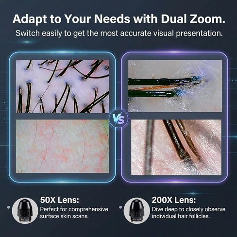 Scalp and Hair Follicle Analyzer, 11-Inch HD Display Digital Microscope Camera with 50X & 200X Dual Lenses, Skin and Hair Condition Magnifier for Salon Professionals and Home Use in Kuwait