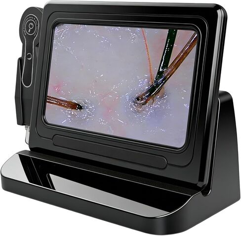 Scalp and Hair Follicle Analyzer, 11-Inch HD Display Digital Microscope Camera with 50X & 200X Dual Lenses, Skin and Hair Condition Magnifier for Salon Professionals and Home Use in Kuwait