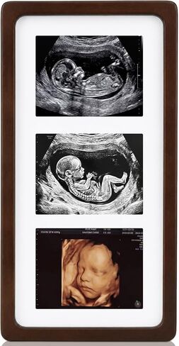 Junkin Ultrasound Picture Frames Non-tarnish Sonogram Photo Frame Love at First Sight Pregnancy Announcements Gift for First Time Moms Table Display Baby Shower Party Decoration(8 x 6 Inch,Rustic) in Kuwait