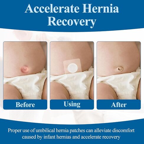 10Pcs Baby Belly Navel Patches, Waterproof Umbilical Hernia Patch with Cotton Pads, Infant Belly Button Corrector for Newborns with Protruding Navel, 3.15×3.15 Inch, Gentle Baby Essentials in Kuwait