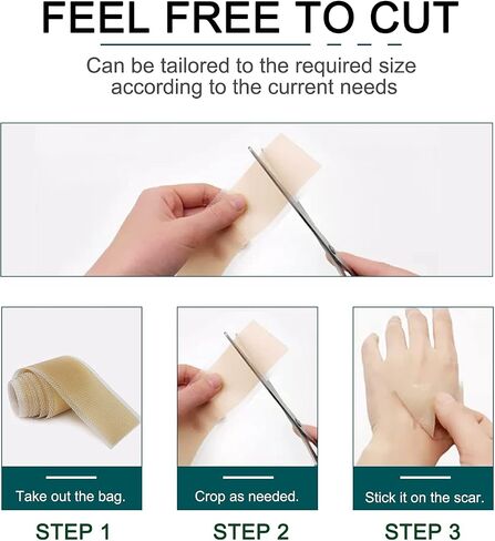 Silicone Scar Sheets (1.6" x 120"Roll-3M), Silicone Scar Tape Roll, Scar Silicone Strips, Reusable, Professional Scar Removal Sheets for C-Section, Surgery, Burn, Keloid, Acne et in Saudi Arabia