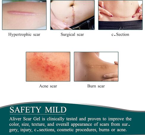 Silicone Scar Sheets (1.6" x 120"Roll-3M), Silicone Scar Tape Roll, Scar Silicone Strips, Reusable, Professional Scar Removal Sheets for C-Section, Surgery, Burn, Keloid, Acne et in Saudi Arabia