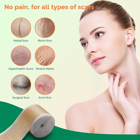 أوراق ندبات السيليكون (1.6 بوصة × 120 بوصة - 3 متر) شريط إزالة الندبات السيليكون القابل لإعادة الاستخدام من الدرجة الطبية الاحترافية للندبات الجراحية، القسم القيصري، الجراحة، الحروق، الجدرة، حب الشباب in Kuwait