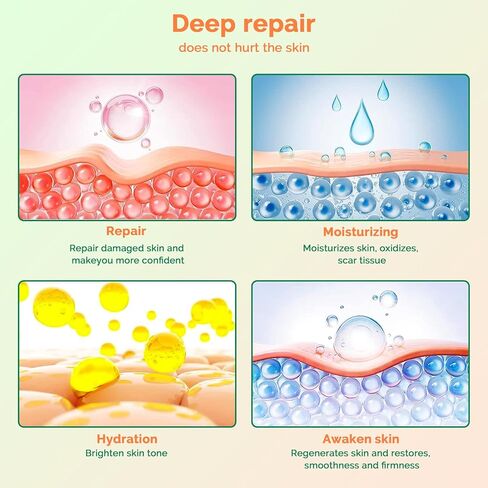 أوراق ندبات السيليكون (1.6 بوصة × 120 بوصة - 3 متر) شريط إزالة الندبات السيليكون القابل لإعادة الاستخدام من الدرجة الطبية الاحترافية للندبات الجراحية، القسم القيصري، الجراحة، الحروق، الجدرة، حب الشباب in Kuwait