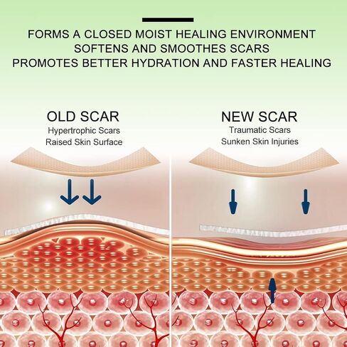 Silicone Scar Sheets(1.57" x 118"Inch - 3M),Scar Away Scar Tape, Scar Strips, Reusable, Professional Scar Removal Sheets for C-Section, Surgery, Burn, Keloid, Acne et, Scar Patch. in Saudi Arabia