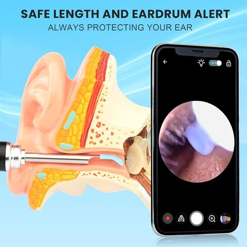 HWAEYEM HD Visible Battery Powered Ear Wax Removal Kit, IP67 1080P Camera 6 LED Lights, Ear Irrigation Flushing System with Basin, WIFI Connection Mobile App Compatible with iPhone iPad Android Phones in Saudi Arabia
