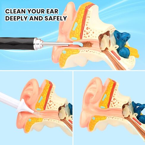 HWAEYEM HD Visible Battery Powered Ear Wax Removal Kit, IP67 1080P Camera 6 LED Lights, Ear Irrigation Flushing System with Basin, WIFI Connection Mobile App Compatible with iPhone iPad Android Phones in Saudi Arabia