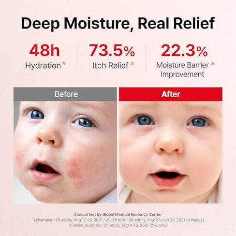 ATOPALM MLE Eczema Cream 65ml and 160ml Bundle in Kuwait