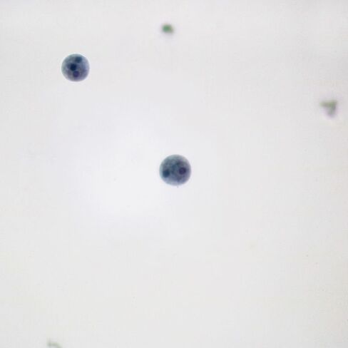 Entamoeba histolytica Cysts, Smear Microscope Slide in Kuwait