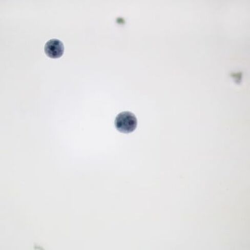 Entamoeba histolytica Cysts, Smear Microscope Slide in Kuwait