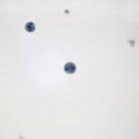 Entamoeba histolytica Cysts, Smear Microscope Slide in Kuwait