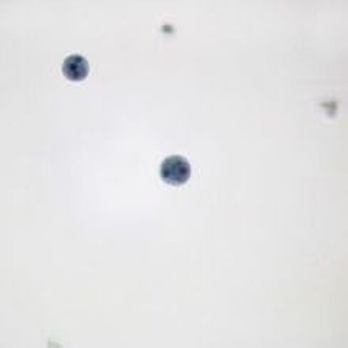 Entamoeba histolytica Cysts, Smear Microscope Slide in Kuwait