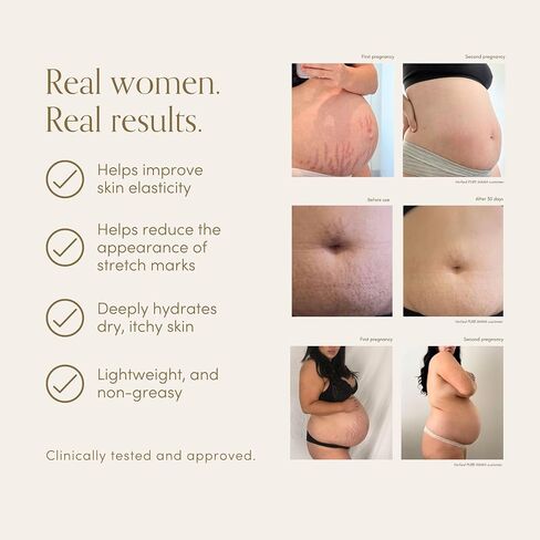 Belly Oil for Pregnancy, Dermatologically & Clinically Tested for Stretch Marks, Improves Hydration & Elasticity, Natural & Organic + Jojoba, Sweet Almond Oil & Vitamin E, 4.9 fl.oz in Kuwait