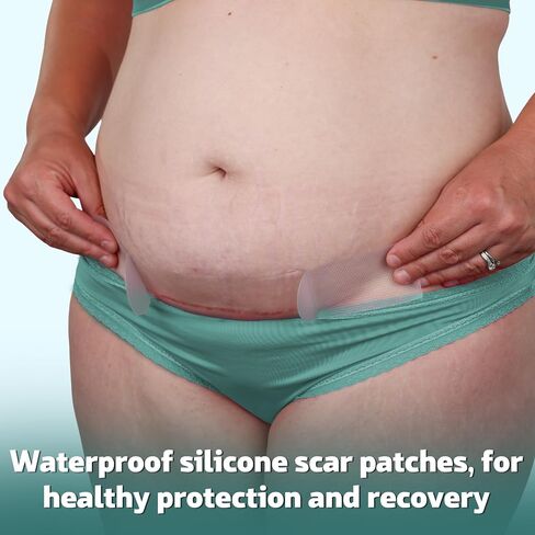 Mama & Wish® C-Section Recovery Kit – Postpartum Essentials C Section 12-Pc: Belly Binder, Silicone Scar Patches, Peri Bottle, Disposable Underwear, Wipes, Grip Socks & Toiletry Bag in Kuwait