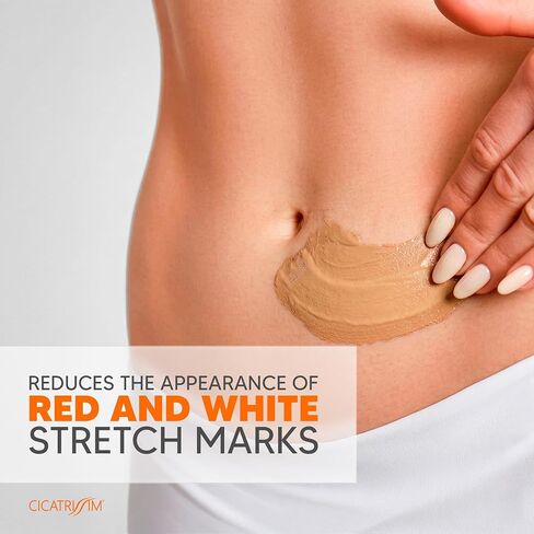 Cicatrissim Stretch Mark Cream for Red and White Striae - Softens Stretch Marks, Evens Skin Tone, and Firms Skin - All Skin Types - 150g in Kuwait