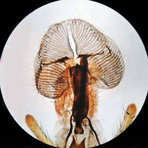AmScope - MD35A MD35 New Microscope Imager Digital USB Camera, Compatible with Windows XP/Vista/7/8/10 in Kuwait