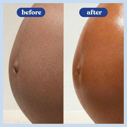 Bumpology Bump Butter, Hydrating Balm for Pregnancy, Stretch Marks, 4 oz | 3-in-1 Belly Balm, Dry Skin, Stretch Marks, Moisturizing Shea & Cocoa Butter, Vitamin E, Physician Formulated in Saudi Arabia
