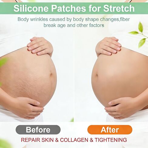 VolksRose Reusable Silicone Belly Patch for Lifting - Stomach tape for Postpartum Recovery & Stretch Marks, Moisturizing Anti-Wrinkle Skin Tape for Tummy Shaping, Firming & Invisible Wear Overnight in Kuwait