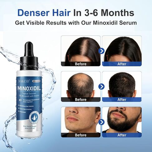 8 Pack 5% Minoxidil Hair Care Serum for Men & Women with Biotin, Castor Oil, Panthenol & Glycerin, Extra Strength Precision Dropper for Thicker Hair, Beard & Hairline, 8 Month Routine Supply in Kuwait