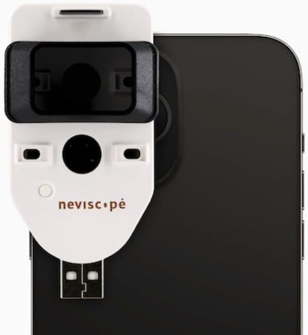 Neviscope Black Phone Dermatoscope Microscope with Polarized Lens/LED Light, 100x Camera Attachment with Universal Clip for Most iPhone/Android Phones Free App in Kuwait