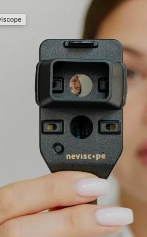 Neviscope Black Phone Dermatoscope Microscope with Polarized Lens/LED Light, 100x Camera Attachment with Universal Clip for Most iPhone/Android Phones Free App in Kuwait