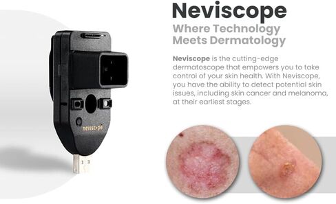 Neviscope Black Phone Dermatoscope Microscope with Polarized Lens/LED Light, 100x Camera Attachment with Universal Clip for Most iPhone/Android Phones Free App in Kuwait